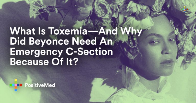 What Is Toxemia—And Why Did Beyonce Need An Emergency C-Section Because Of It?