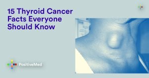 15 Thyroid Cancer Facts Everyone Should Know