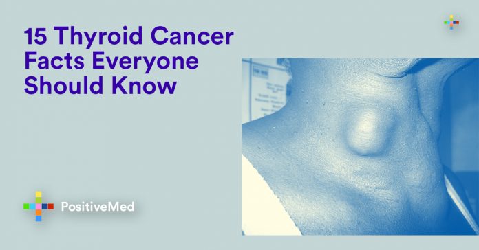 15 Thyroid Cancer Facts Everyone Should Know