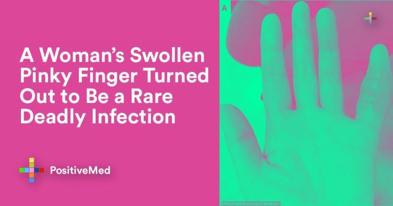 A Woman’s Swollen Pinky Finger Turned Out to Be a Rare Deadly Infection