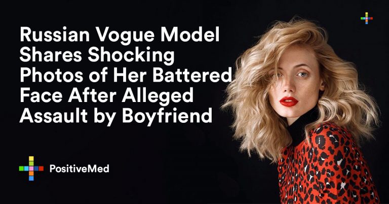 Russian Vogue Model Shares Shocking Photos of Her Battered Face After Alleged Assault by Boyfriend