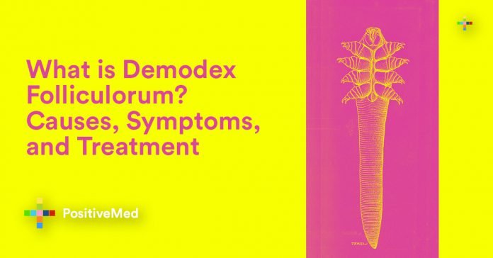 What is Demodex Folliculorum Causes, Symptoms, and Treatment