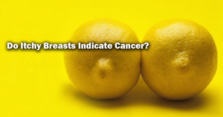 Do Itchy Breasts Indicate Cancer? Do Itchy Breasts Indicate Cancer?