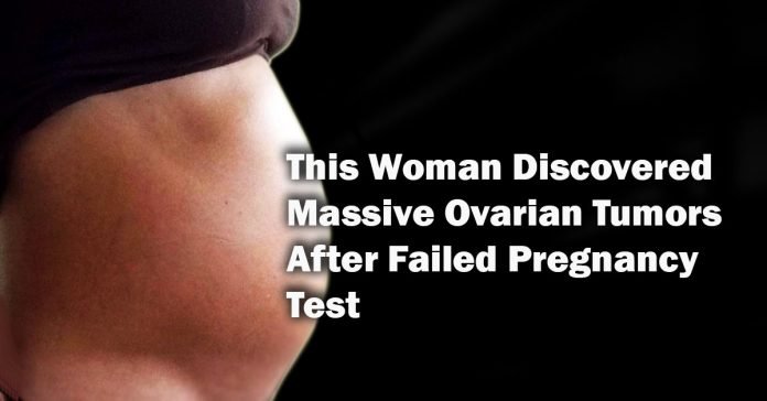 This Woman Discovered Massive Ovarian Tumors After Failed Pregnancy Test