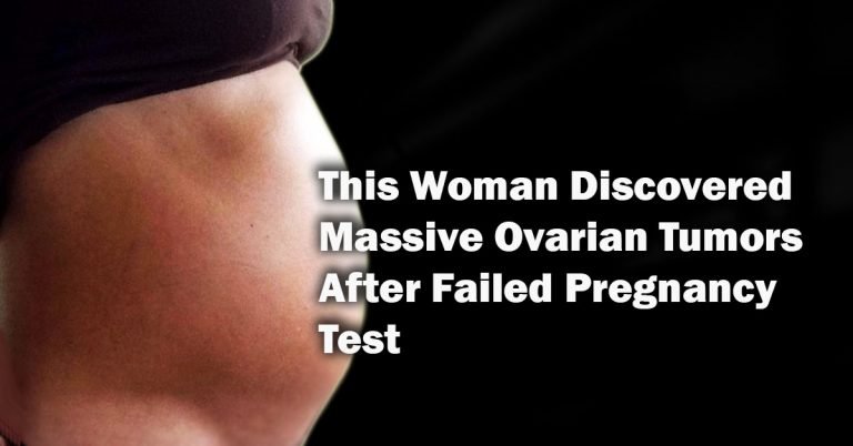 This Woman Discovered Massive Ovarian Tumors After Failed Pregnancy Test This Woman Discovered Massive Ovarian Tumors After Failed Pregnancy Test