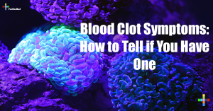 Blood Clot Symptoms: How to Tell if You Have One