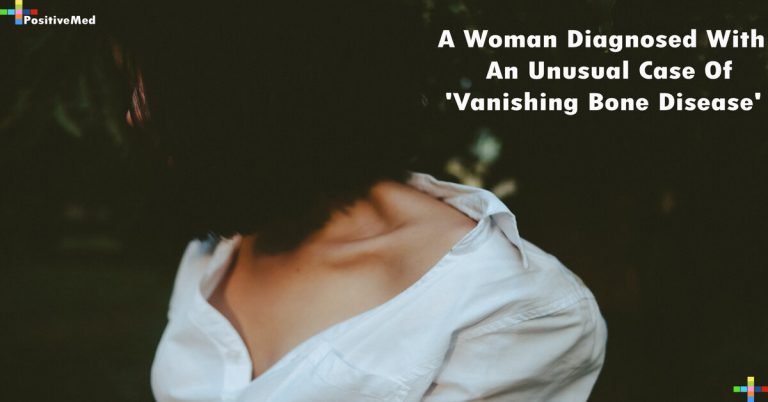 A Woman Diagnosed With An Unusual Case Of ‘Vanishing Bone Disease’ A Woman Diagnosed With An Unusual Case Of ‘Vanishing Bone Disease’