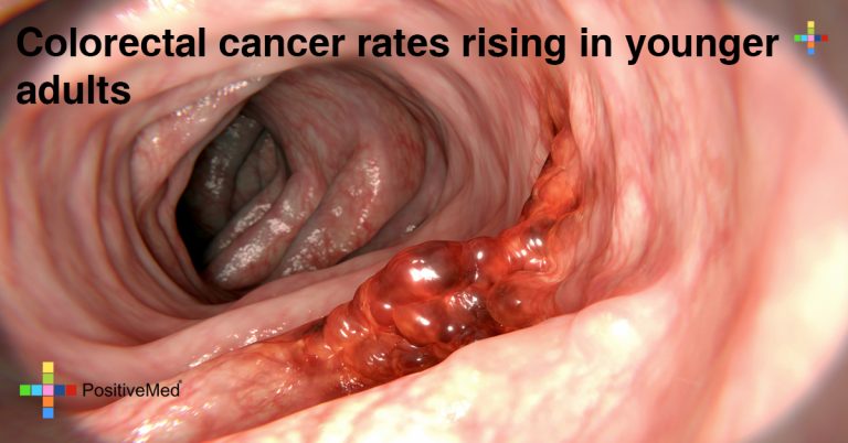 Colorectal Cancer Rates Rising In Younger Adults  