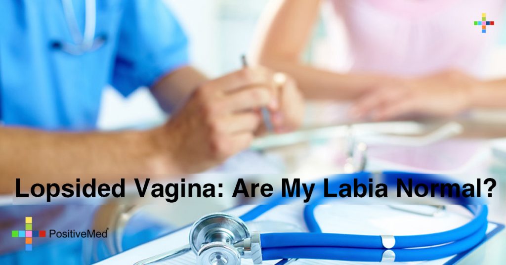 Lopsided Vagina: Are My Labia Normal?