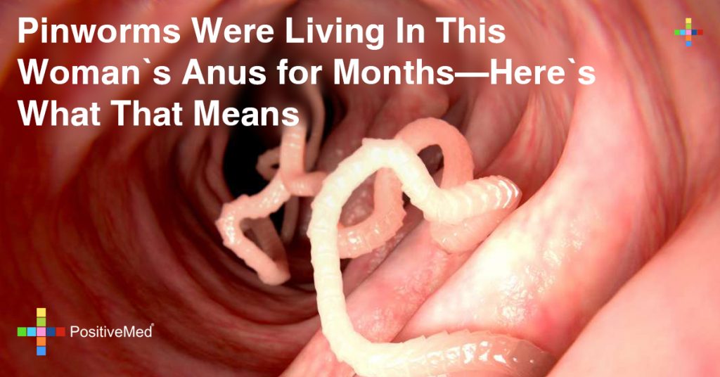 Pinworms-Were-Living-In-This-Woman’s-Anus-for-Months-Here’s-What-That-Means
