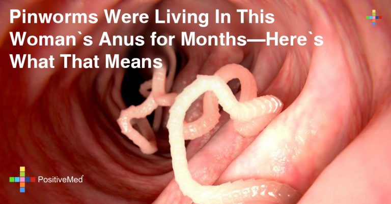 Pinworms Were Living In This Woman’s Anus for Months: What It Means