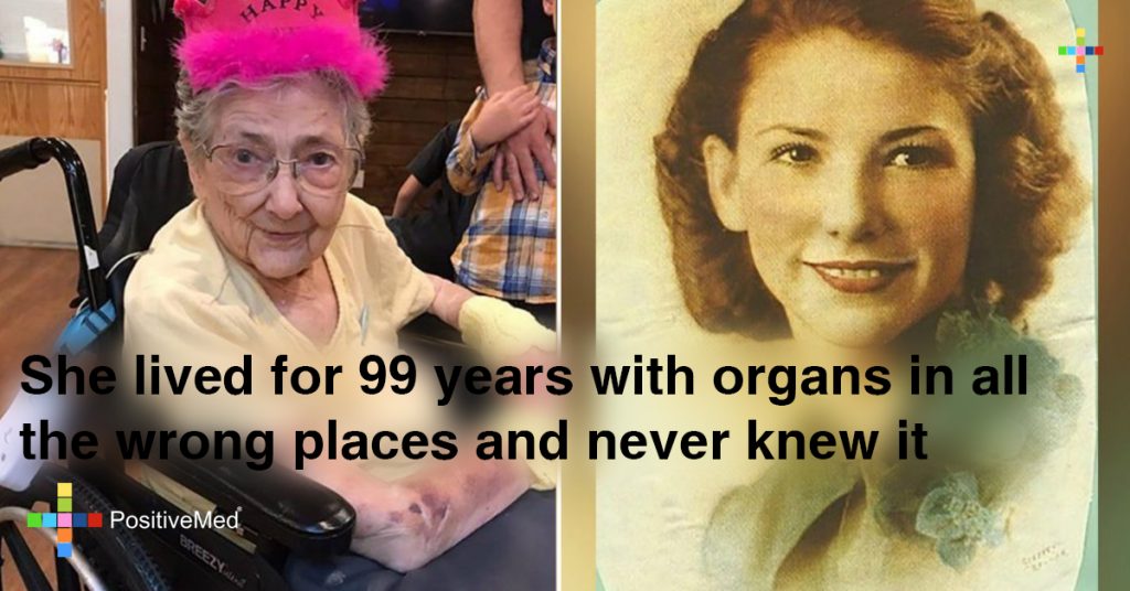 She Lived for 99 Years with Organs in all the Wrong Places and Never Knew it