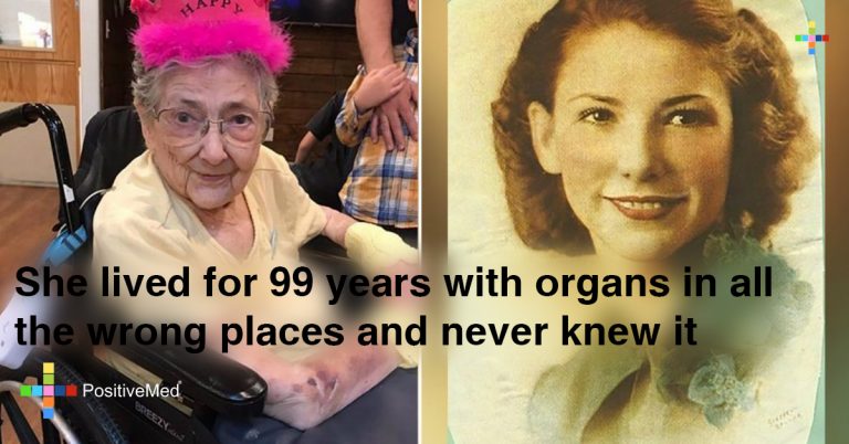 She Lived for 99 Years with Organs in all the Wrong Places and Never Knew it She Lived for 99 Years with Organs in all the Wrong Places and Never Knew it