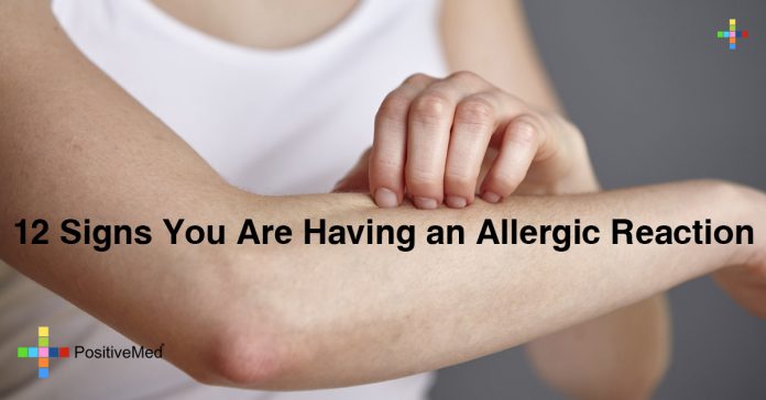 12 Signs You Are Having an Allergic Reaction