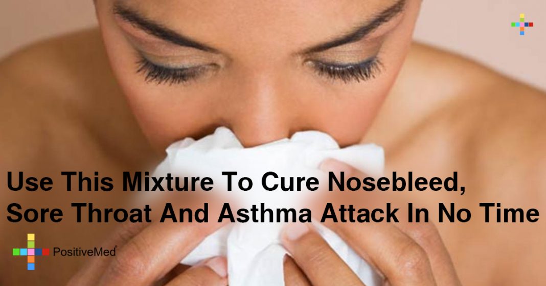 Use This Mixture To Cure Nosebleed, Sore Throat And Asthma Attack In No Time PositiveMed