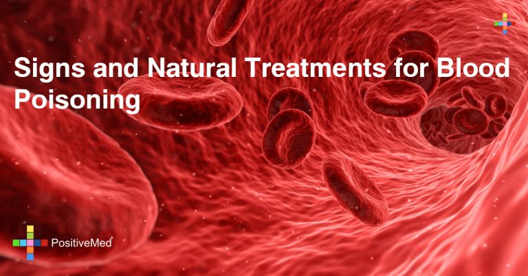 Signs and Natural Treatments for Blood Poisoning Signs and Natural Treatments for Blood Poisoning
