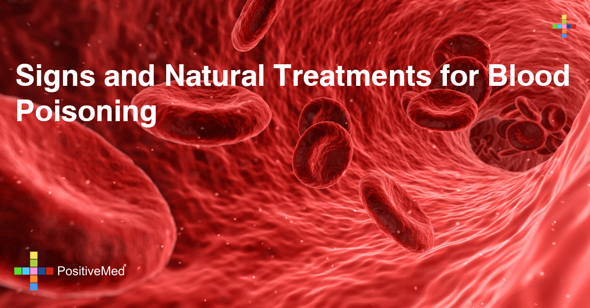 Signs and Natural Treatments for Blood Poisoning PositiveMed