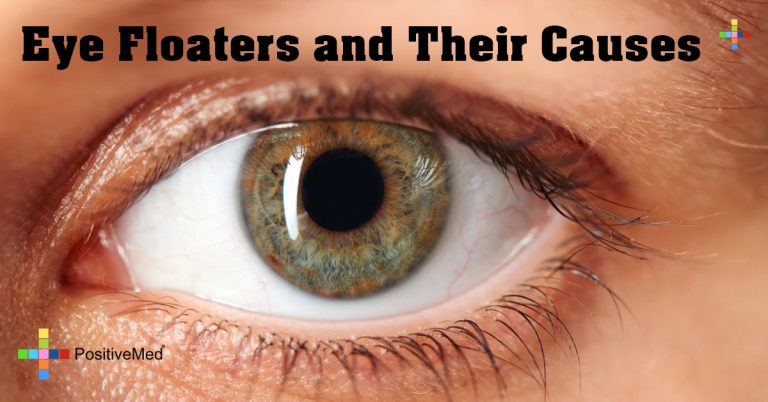 floaters in eyes floaters in eyes