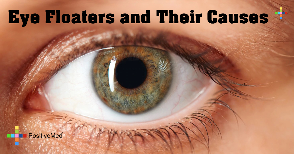 83EyeFloatersandTheirCauses PositiveMed