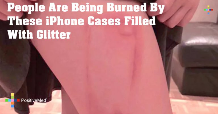 People Are Being Burned By These iPhone Cases Filled With Glitter People Are Being Burned By These iPhone Cases Filled With Glitter