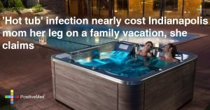 ‘Hot tub’ Infection Nearly Cost a Woman her Leg on a Family Vacation