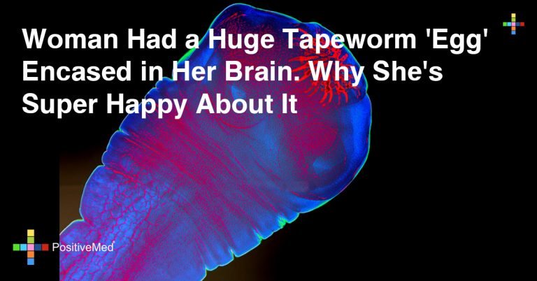 Woman Had a Huge Tapeworm ‘Egg’ Encased in Her Brain. Why She’s Super Happy About It Woman Had a Huge Tapeworm ‘Egg’ Encased in Her Brain. Why She’s Super Happy About It