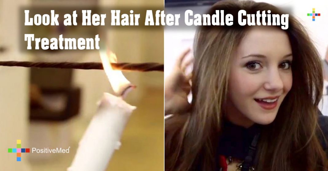 Look at Her Hair After Candle Cutting Treatment PositiveMed