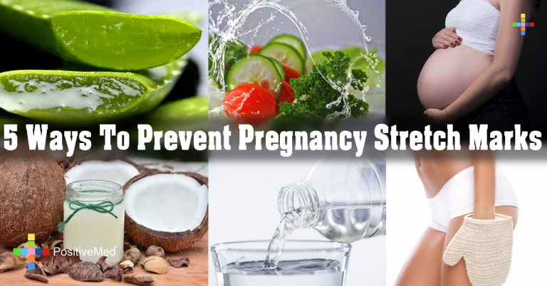 5 Ways To Prevent Pregnancy Stretch Marks