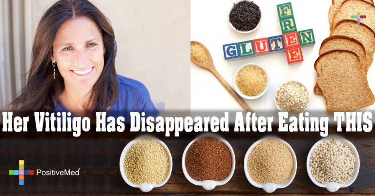 Her Vitiligo Has Disappeared After Eating THIS Her Vitiligo Has Disappeared After Eating THIS