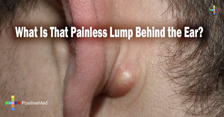 What Is That Painless Lump Behind the Ear?