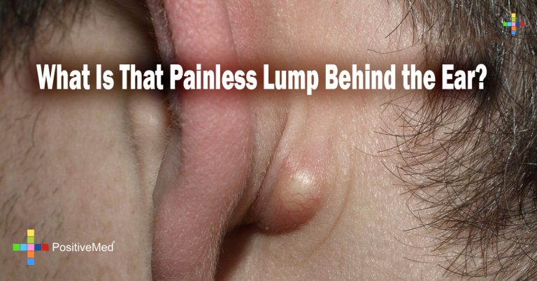 What Is That Painless Lump Behind the Ear? What Is That Painless Lump Behind the Ear?