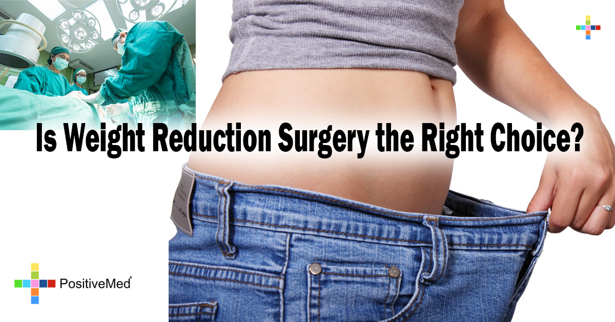 Is Weight Reduction Surgery the Right Choice? PositiveMed