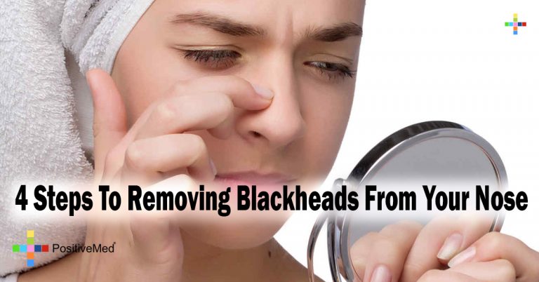 4 Steps To Removing Blackheads From Your Nose 4 Steps To Removing Blackheads From Your Nose