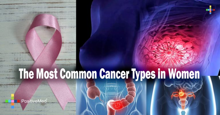 The Most Common Cancer Types in Women The Most Common Cancer Types in Women