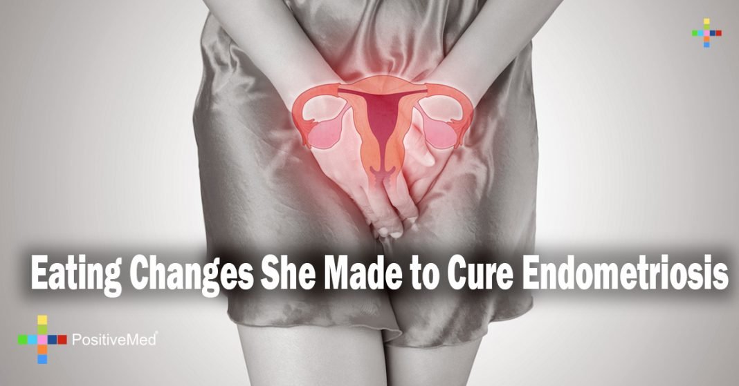 Eating Changes She Made to Cure Endometriosis PositiveMed