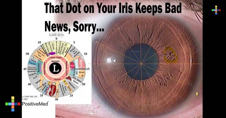 That Dot on Your Iris Keeps Bad News, Sorry… That Dot on Your Iris Keeps Bad News, Sorry…