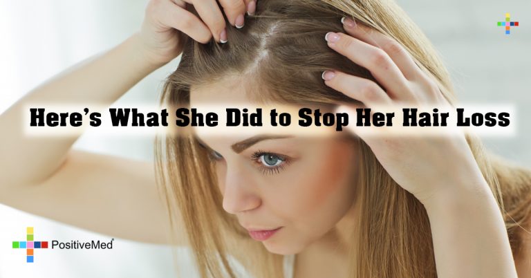 Here’s What She Did to Stop Her Hair Loss Here’s What She Did to Stop Her Hair Loss