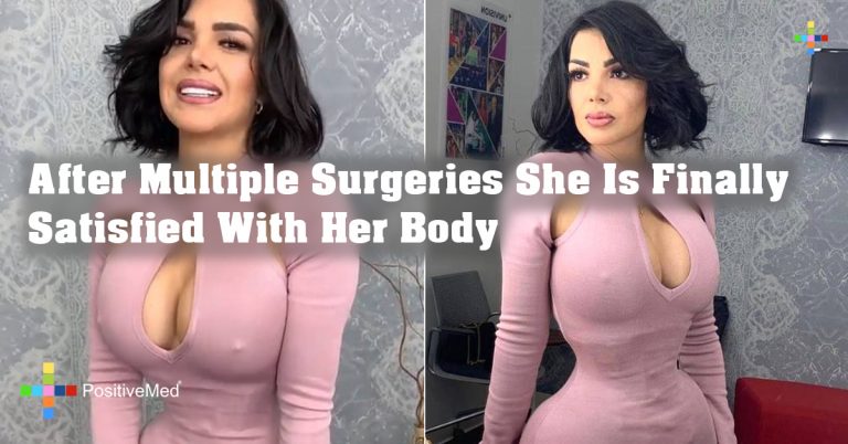 After Multiple Surgeries She Is Finally Satisfied With Her Body