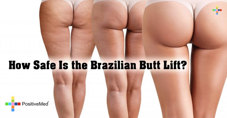 How Safe is the Brazilian Butt Lift? How Safe is the Brazilian Butt Lift?