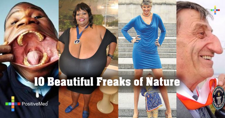 10 Beautiful Freaks of Nature