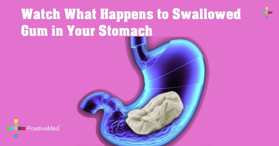 Watch What Happens to Swallowed Gum in Your Stomach PositiveMed