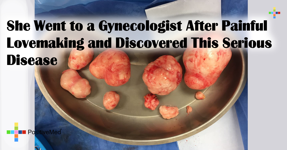 She Went to a Gynecologist After Painful Lovemaking and Discovered This Serious Disease