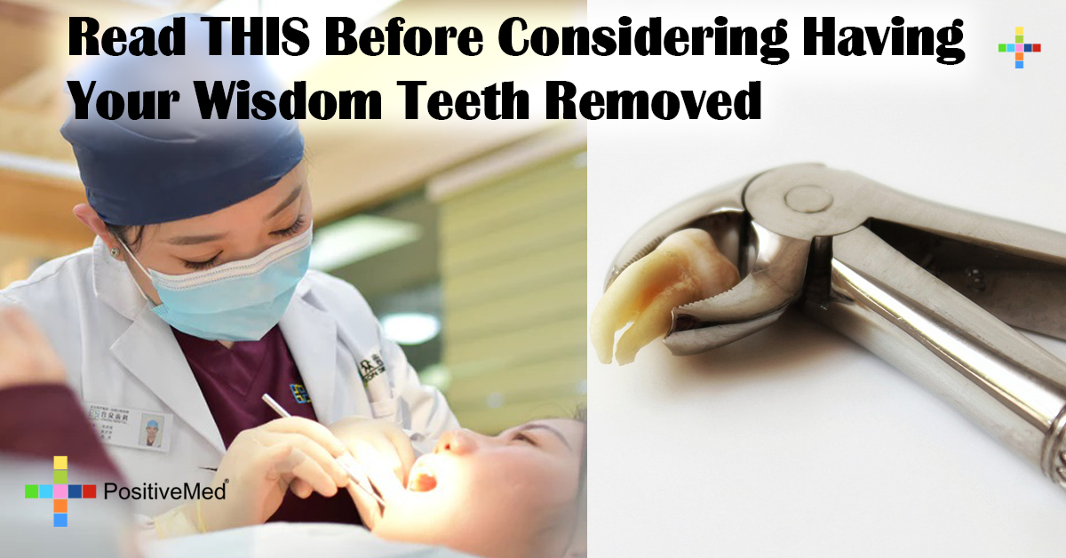 Read THIS Before Considering Having Your Wisdom Teeth Removed