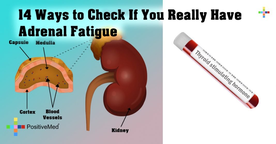 14 Ways to Check If You Really Have Adrenal Fatigue PositiveMed