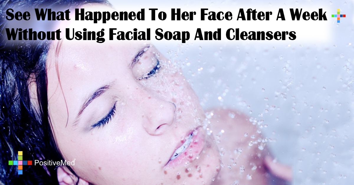 See What Happened To Her Face After A Week Without Using Facial Soap And Cleansers
