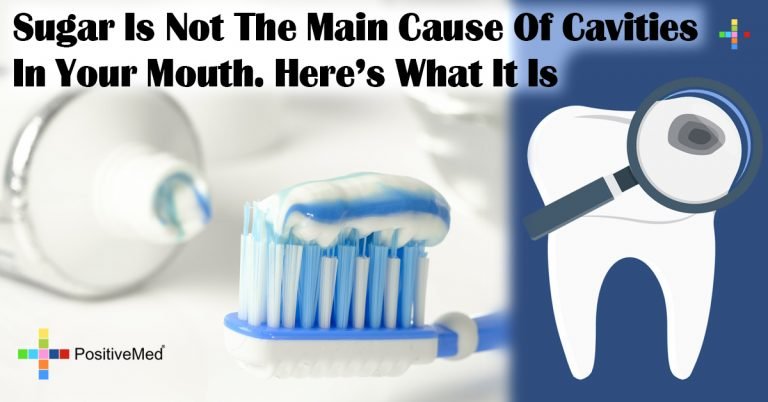Sugar Is Not The Main Cause Of Cavities In Your Mouth. Here’s What It Is Sugar Is Not The Main Cause Of Cavities In Your Mouth. Here’s What It Is