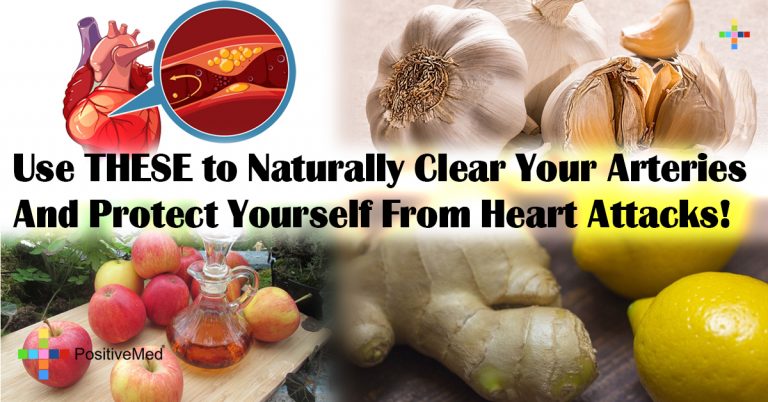 Use THESE to Naturally Clear Your Arteries And Protect Yourself From Heart Attacks!