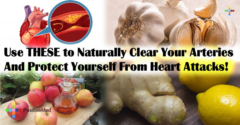 Use THESE to Naturally Clear Your Arteries And Protect Yourself From Heart Attacks! Use THESE to Naturally Clear Your Arteries And Protect Yourself From Heart Attacks!