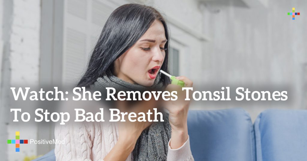 Watch: She Removes Tonsil Stones to Stop Bad Breath