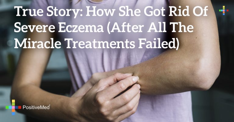 True Story: How She Got Rid of Severe Eczema (After All the Miracle Treatments Failed) True Story: How She Got Rid of Severe Eczema (After All the Miracle Treatments Failed)